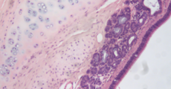 article primary image